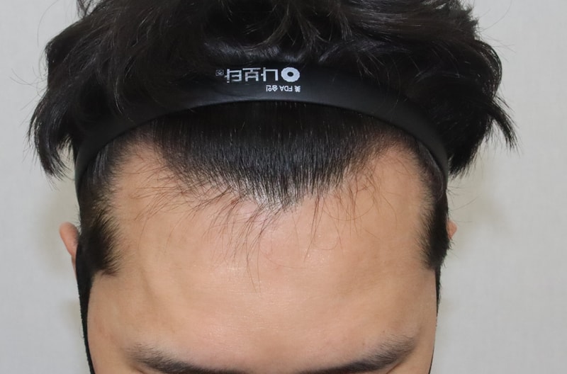 전.JPG