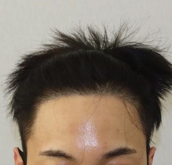 전 2.JPG