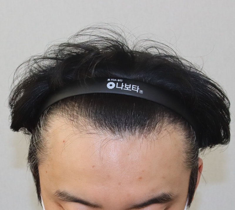 수술 전 2.JPG