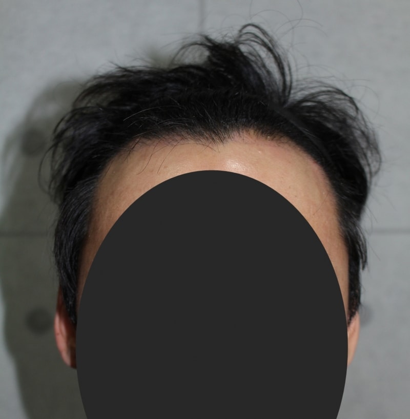 이식한지도 벌써 한달 반이나 지났네요