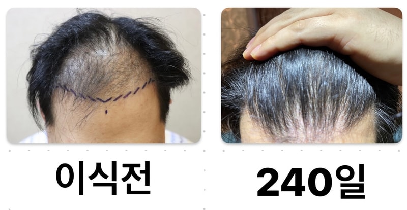 240일 경과 입니다..