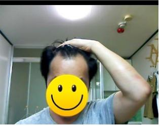 수술전1.jpg