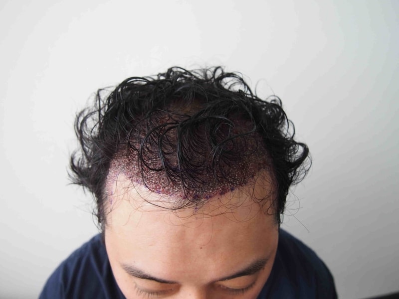 수술직후 1.JPG