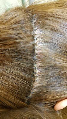 IMG_20170419_230501.jpg.jpg