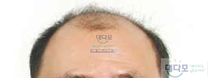 10년후.jpg