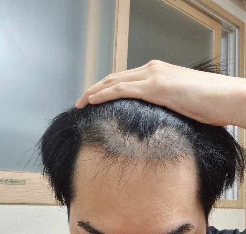 앞머리 4.jpg