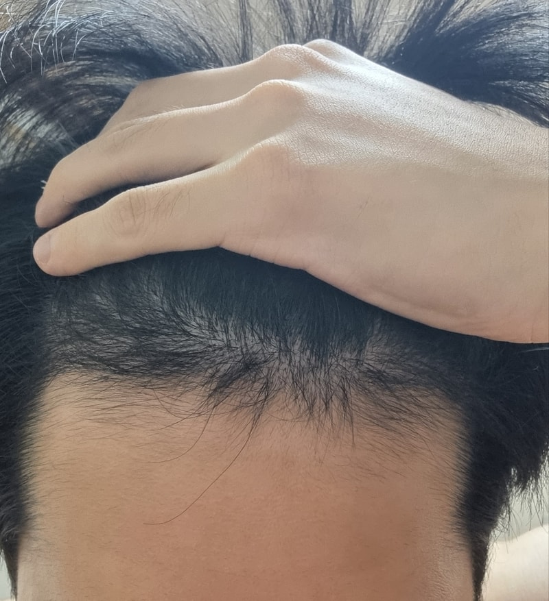 앞머리 4.jpg