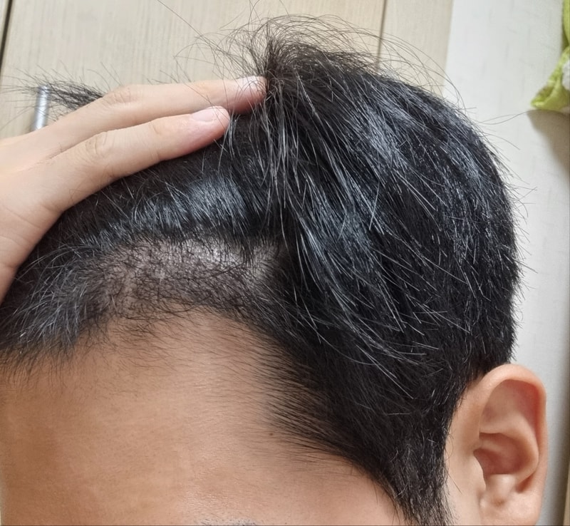 왼쪽.jpg