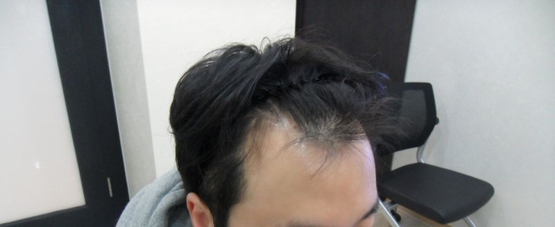 이승용_상담때.JPG