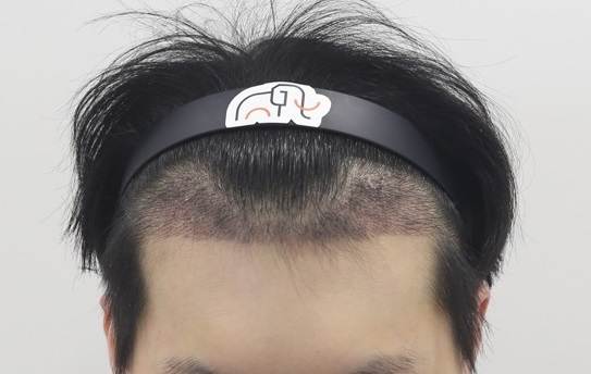 2주_.jpg