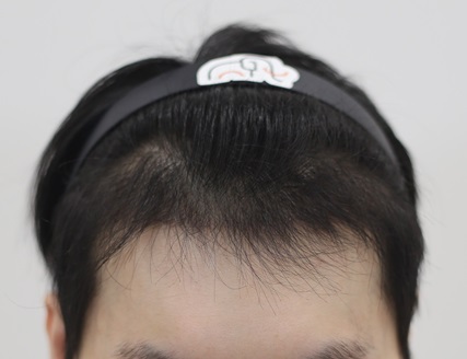 4개월.jpg