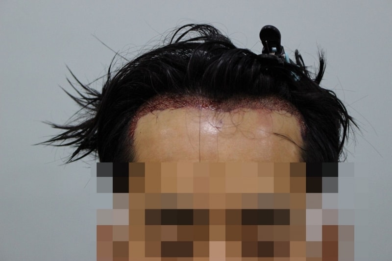 혐주의4.jpg