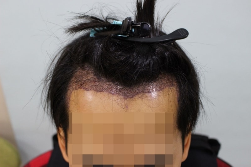 10일차다른각도2.jpg