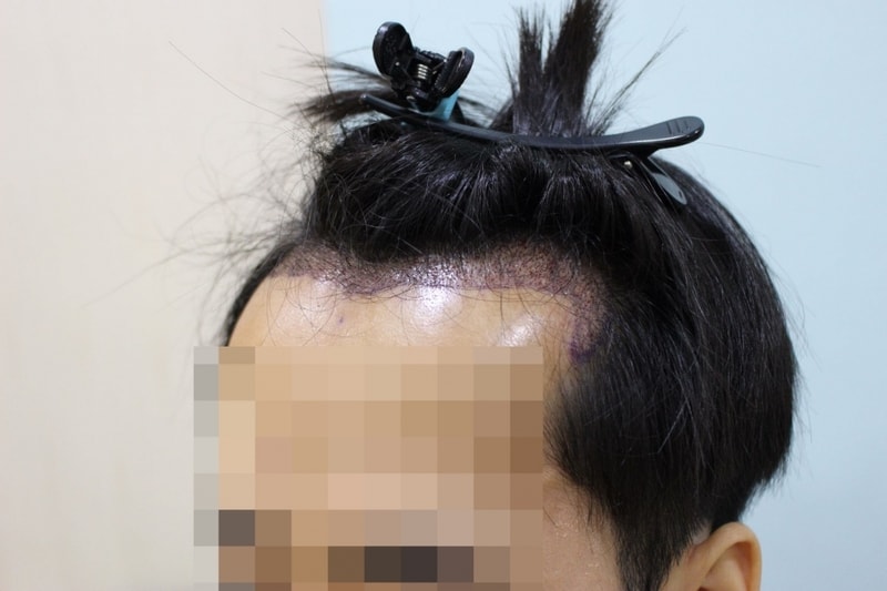 10일차다른각도.jpg