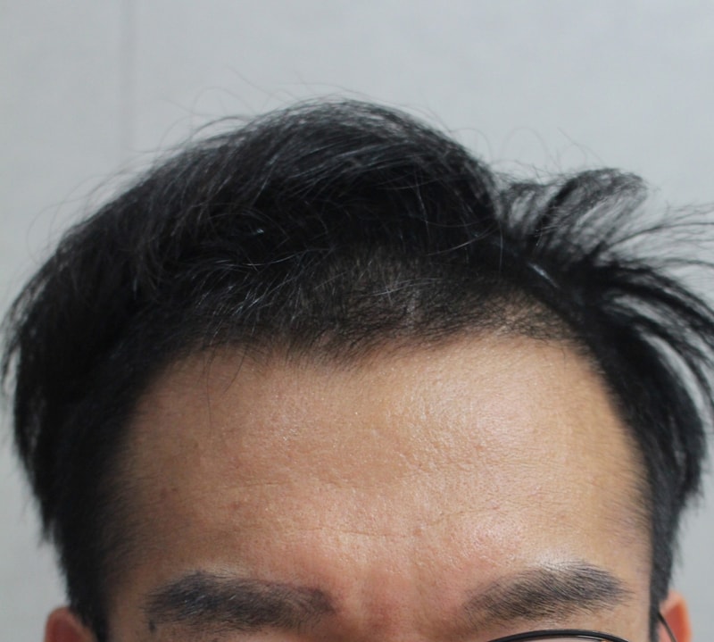 [크기변환]19.5.24 4개월경과 (1).jpg