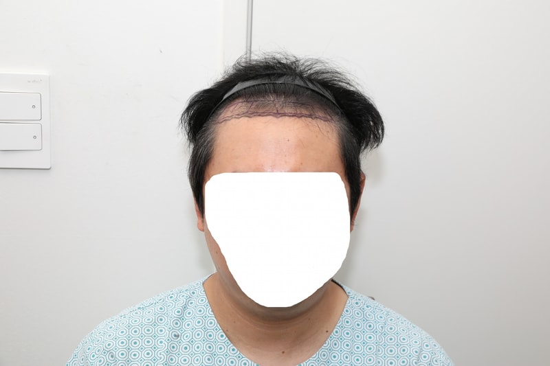 수술전1.jpg