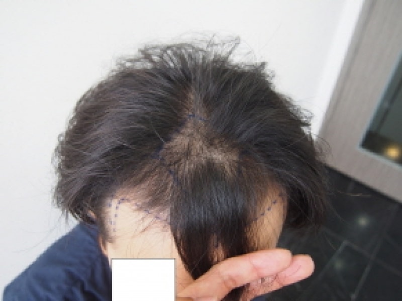 크기변환_수술전 1.JPG