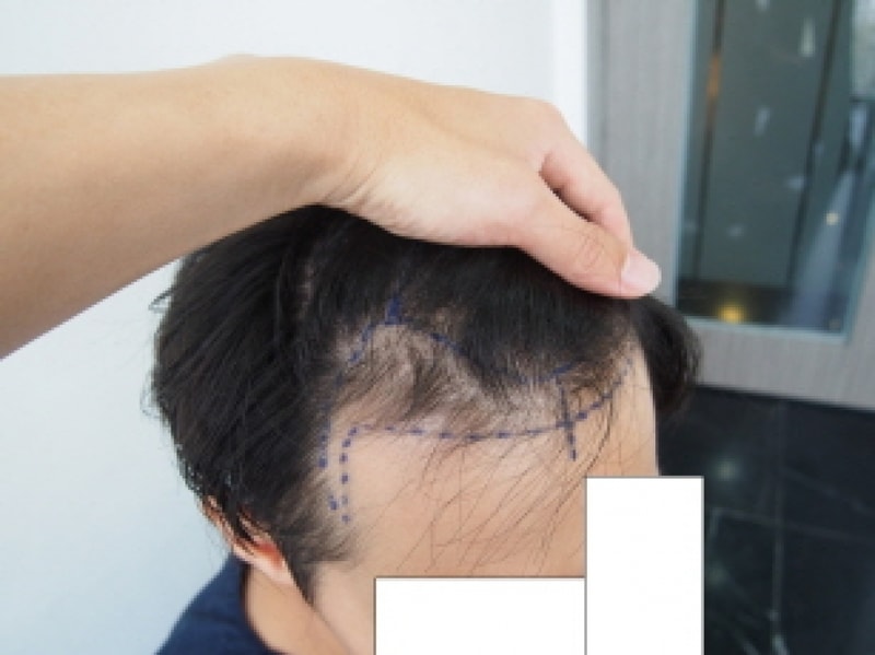 크기변환_수술전 2.JPG