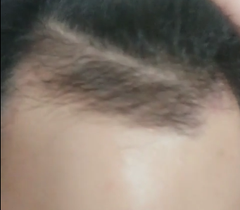 3달 경과-2.PNG
