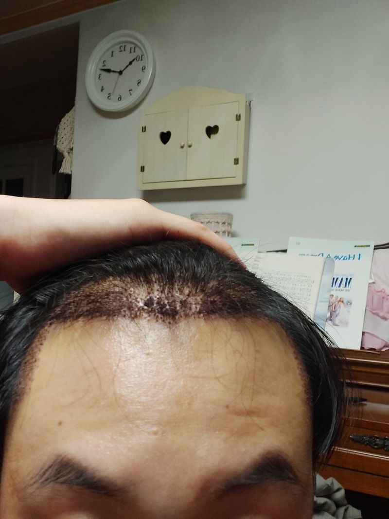 KakaoTalk_20220725_221511255.jpg