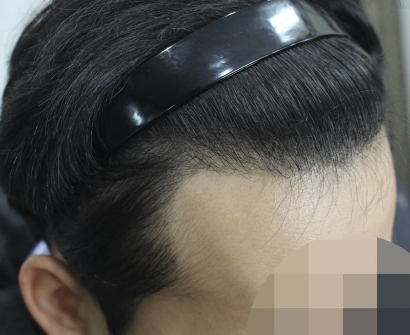 1년 1개월 (3).png