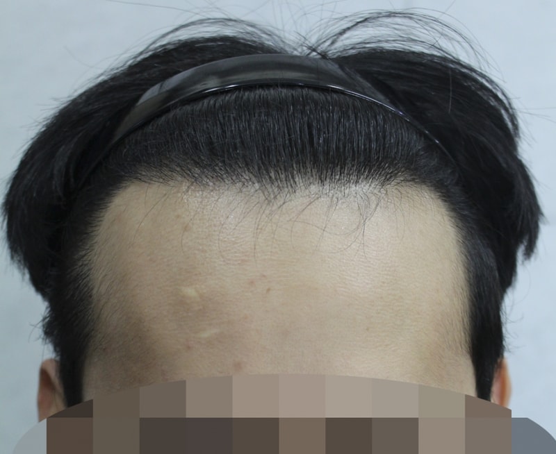 1년 1개월 (7).png