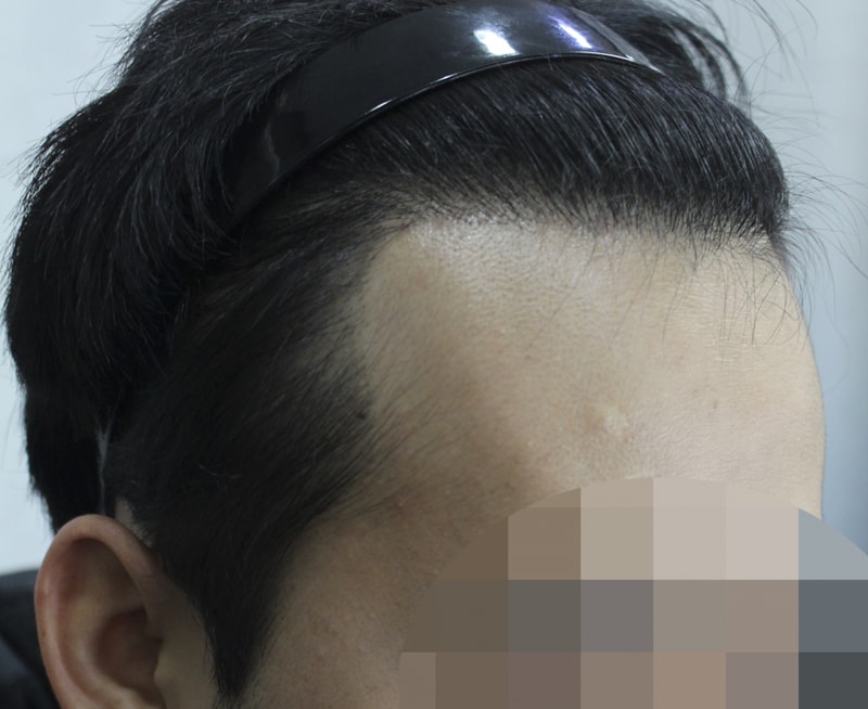 1년 1개월 (5).png