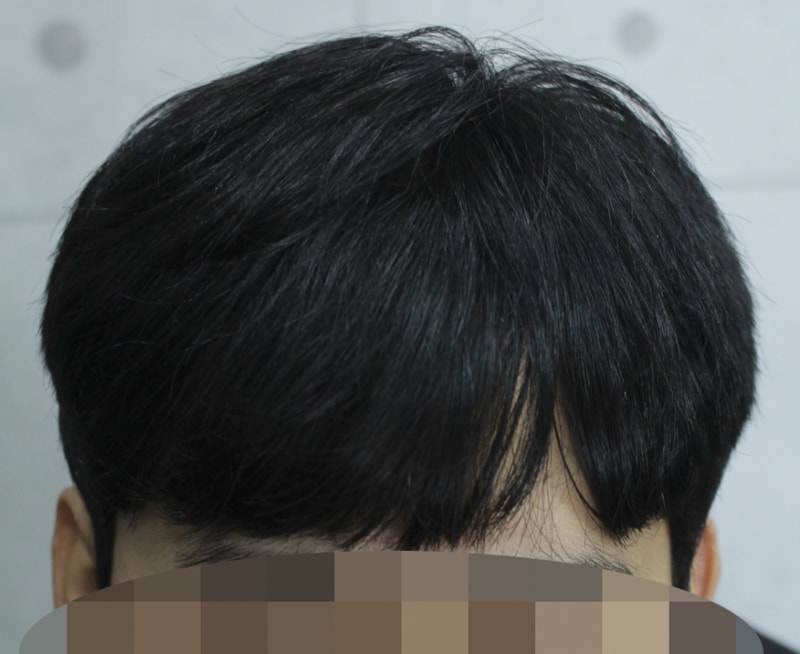 1년 1개월 (1).png