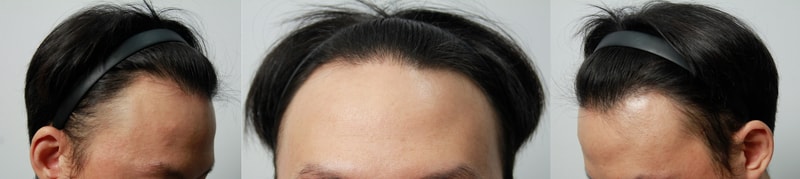 수술전-전체.jpg