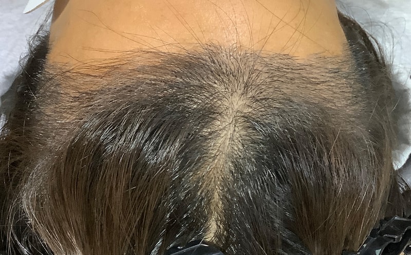 위정면.jpg