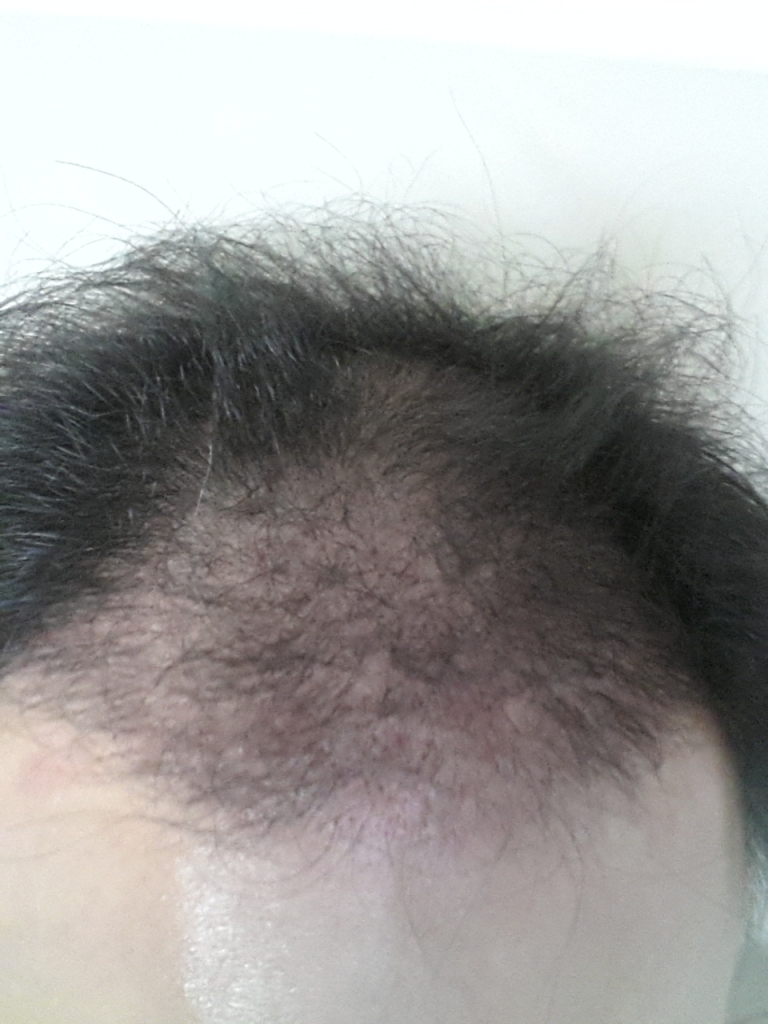 4개월15일뒤2.jpg