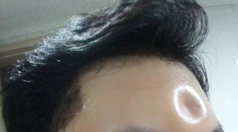 20180122_154951.jpg