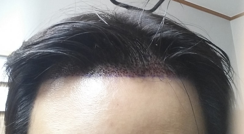 정면.jpg