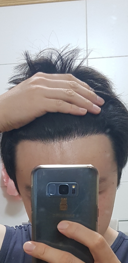 231일 8개월차 입니다.
