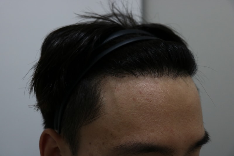 [크기변환]1년경과 오른쪽.jpg