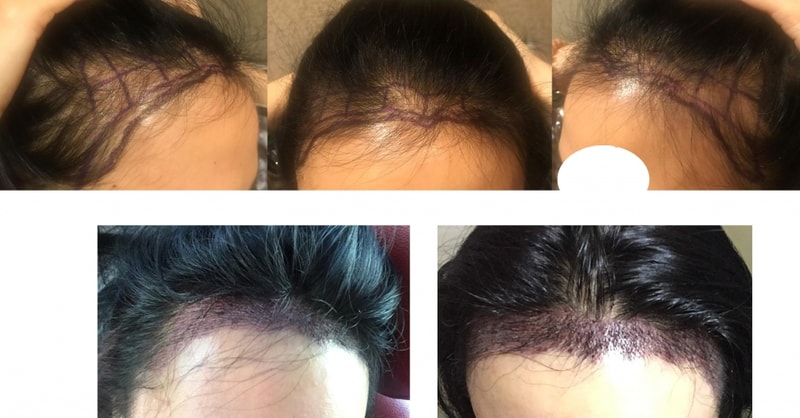 Hair.jpg