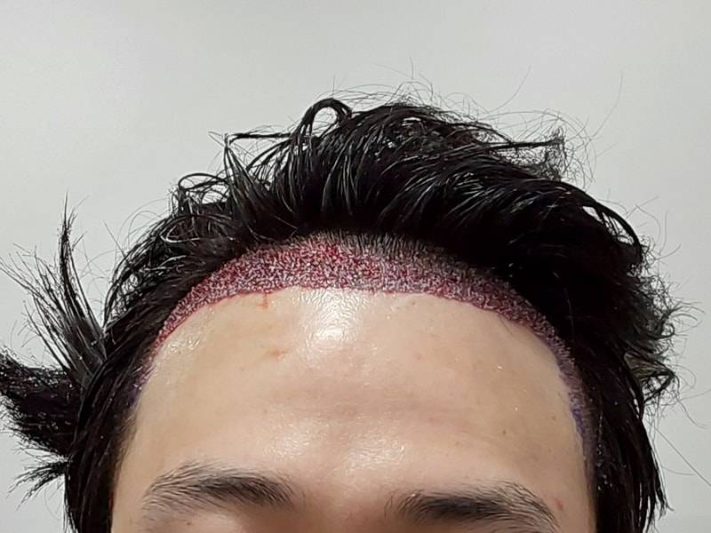 1000019113.jpg