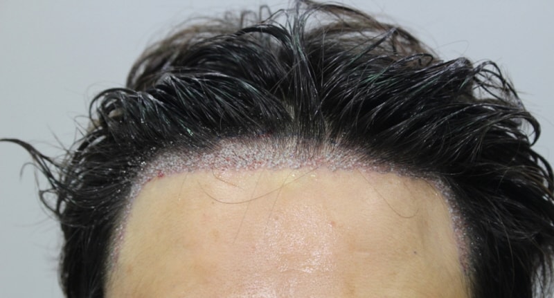 2.수술후1.jpg