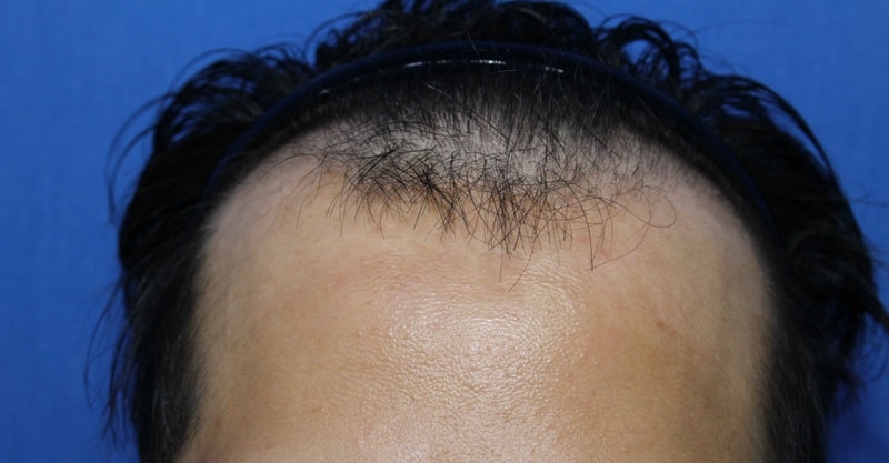 4370 Mo, please evaluate the 5th month