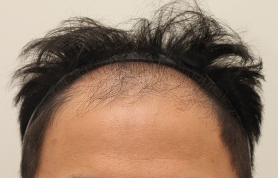 암흑기에 다 빠지지 않겠죠.....