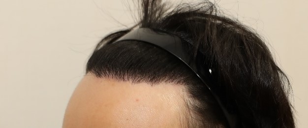 수술후2.jpg