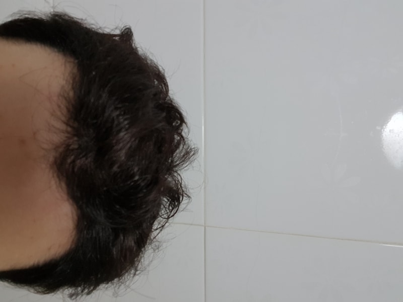 1146모낭 8달 평가