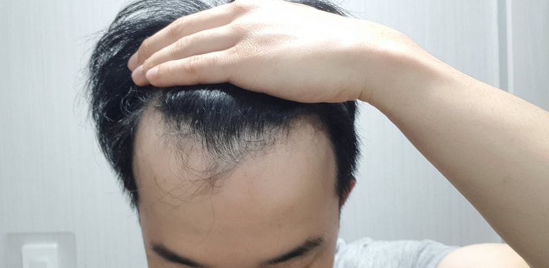 비포1.jpg