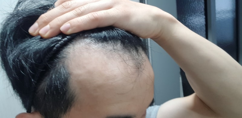 비포2.jpg