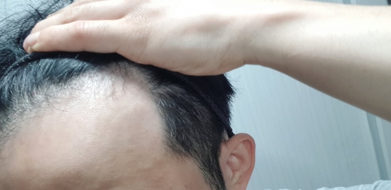 비포3.jpg