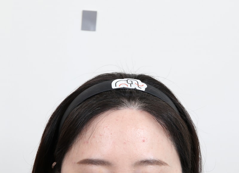 부산 맘모스 헤어라인 7개월차 후기 입니다!