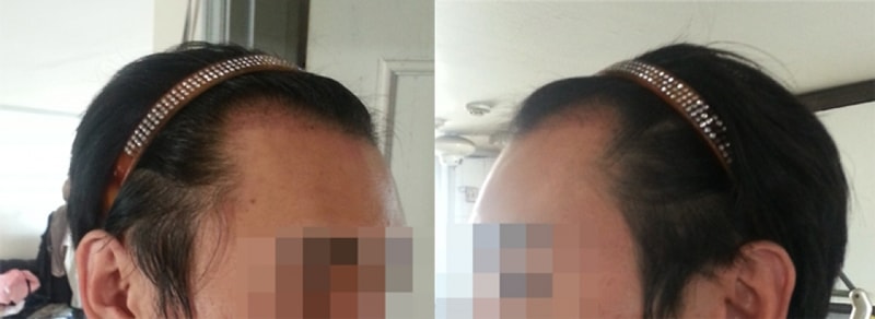 한달차양쪽측면.jpg