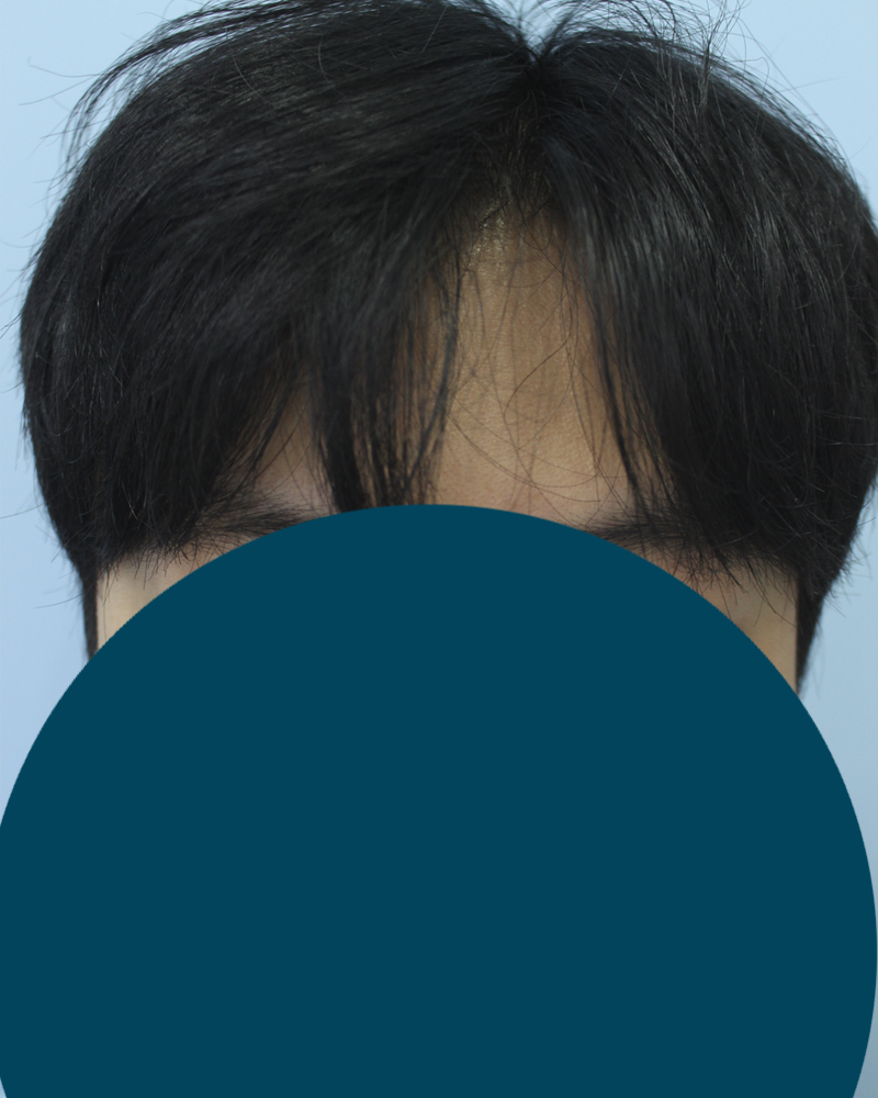 003.jpg