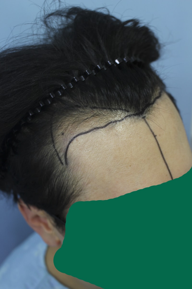 이식을 한지 좀 됐는데 사진 올려볼게요
