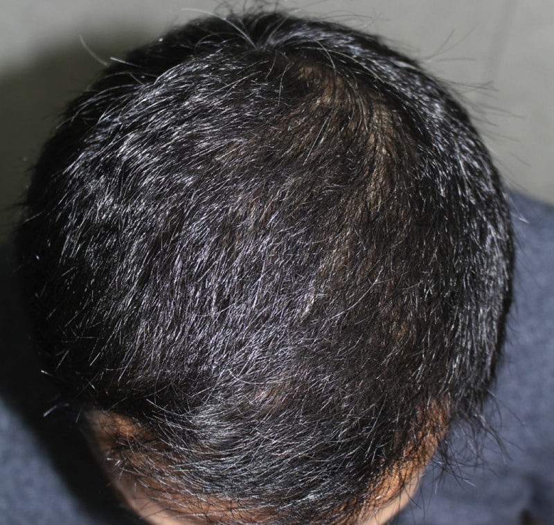 IMG_8133_1년.png